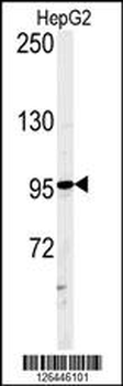 ATXN2L Antibody (C-term)