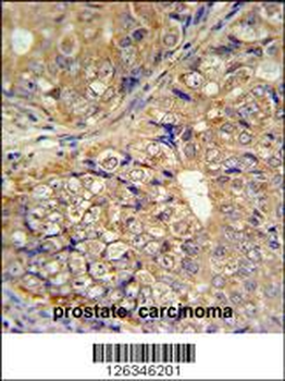 KLHL9 Antibody (Center)