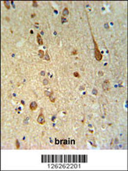 FAAH2 Antibody (C-term)