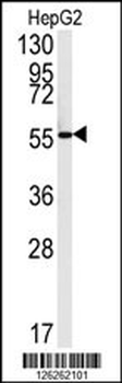 FAAH2 Antibody (C-term)