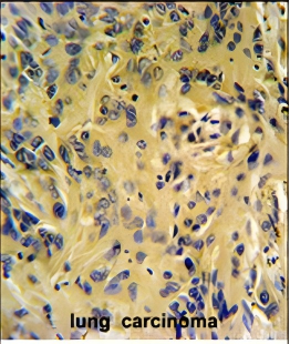 TESC Antibody (C-term)