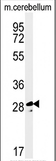 TESC Antibody (C-term)