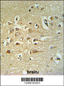 FA40B Antibody (N-term)