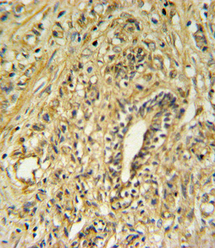 HSD17B2 Antibody (Center)