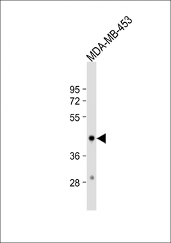 HSD17B2 Antibody (Center)