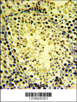 DGKK Antibody (C-term)