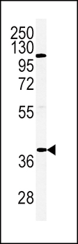 ADIPOR2 Antibody (Center)