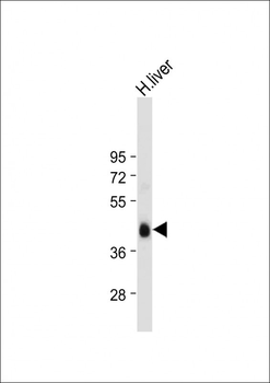 ADIPOR2 Antibody (Center)