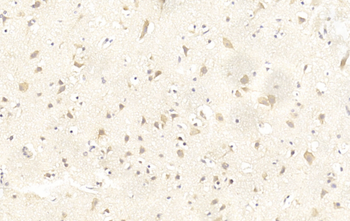LINGO-1(LRRN6A)-S596 (C-term) Antibody
