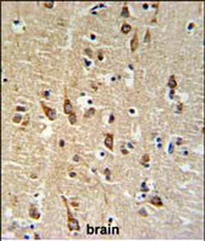 SGTB Antibody (N-term)