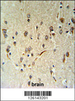 LIMD2 Antibody (N-term)