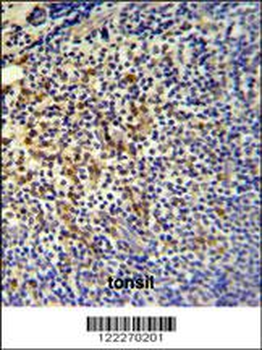 TPPP3 Antibody (C-term)