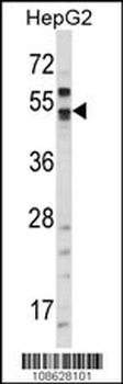 CA9 Antibody (N-term)
