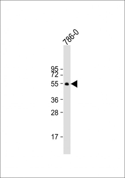 CA9 Antibody (N-term)