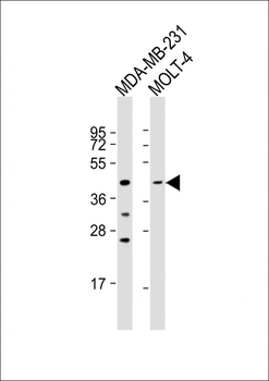 CCR7 Antibody (N-term)