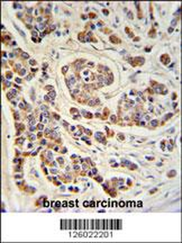 ATHL1 Antibody (C-term)