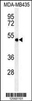 ASM3A Antibody (C-term)