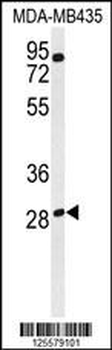 RRAGD Antibody (Center)