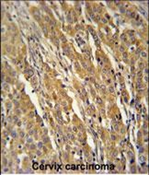 PDXD1 Antibody (C-term)