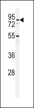 PDXD1 Antibody (C-term)