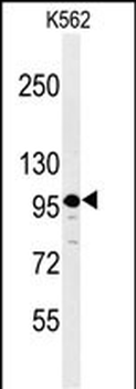 SE6L2 Antibody (C-term)