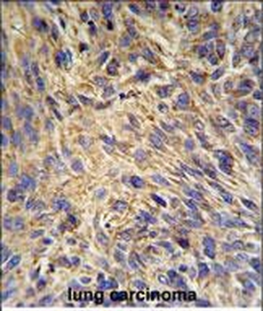 HSP90B1 Antibody (N-term)
