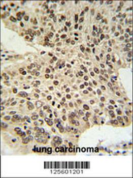 HIST1H2AL Antibody (C-term)