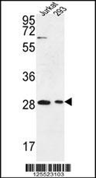 ERMIN Antibody (Center)