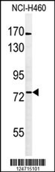 BBS10 Antibody (C-term)