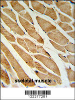 ISLR Antibody (C-term)