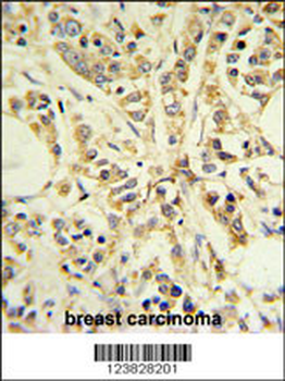 RPS13 Antibody (Center)