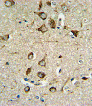 ASMT Antibody (Center)