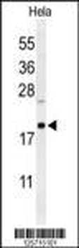 CLEC2B Antibody (Center)