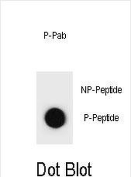 Phospho-TSC1(S1080) Antibody