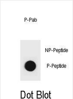 Phospho-PTEN(Y315) Antibody
