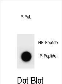 Phospho-PTEN(Y176) Antibody