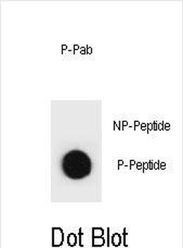 Phospho-rat TSC2(T1373) Antibody