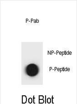 Phospho-mouse TSC1(T310) Antibody