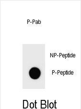 Phospho-IKKB(S692) Antibody