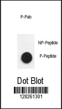 Phospho-Nephrin(Y1193)) Antibody