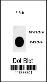 Phospho-ACTH(S168) Antibody