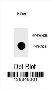 Phospho-FOXP3(S418) Antibody