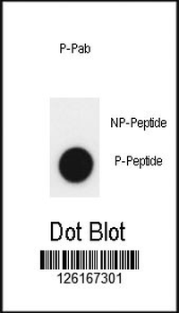Phospho-JMJD2A(Y547) Antibody