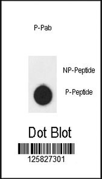 Phospho-AKT1(S124) Antibody
