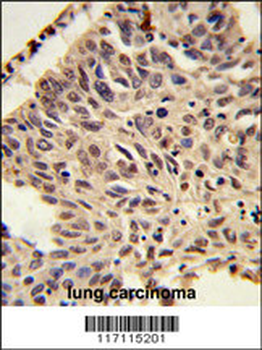 Me2-H4(K20) Antibody