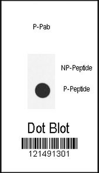Phospho-SRC(Y419) Antibody