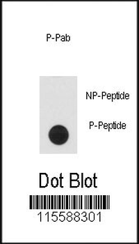 Phospho-CLASP1(T656) Antibody