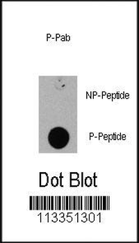 Phospho-EIF4EBP1(S111) Antibody