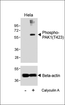 Phospho-PAK1(T423) Antibody