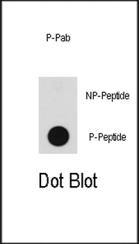 Phospho-BRAF(T598) Antibody